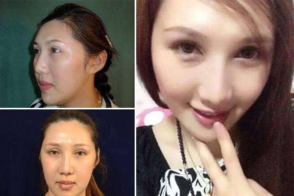 刘馨予是男的还是女的 那么丑的长相正常女人谁是这样的