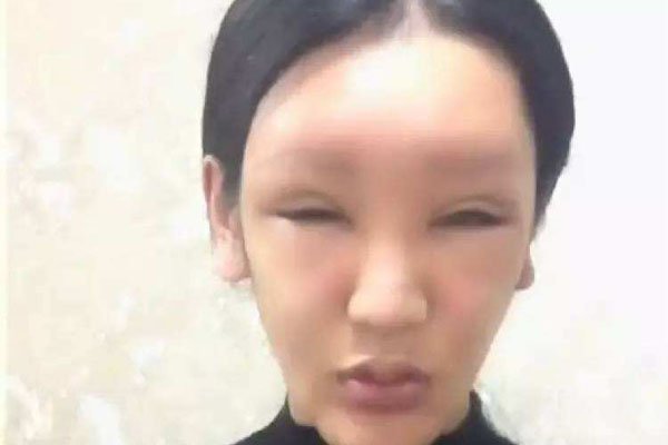 桃花宝宝的简介 花费百万成人造美女如今大网红