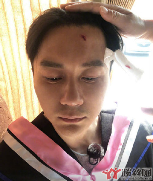 李晨录制跑男意外受伤 网友质疑学士帽究竟能不能砸伤人