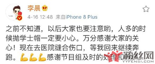 李晨录制跑男意外受伤 网友质疑学士帽究竟能不能砸伤人