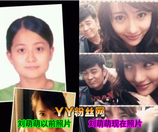 刘萌萌整容前后照片对比 家和万事兴宋香扮演者刘萌萌严重走光