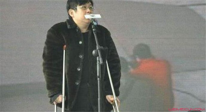郑智化的腿是怎么瘸的 残疾原因曝光