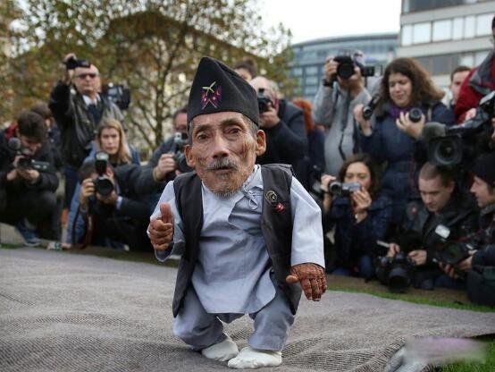 世界最矮的人是谁?有多高 世界最矮的人排名十位