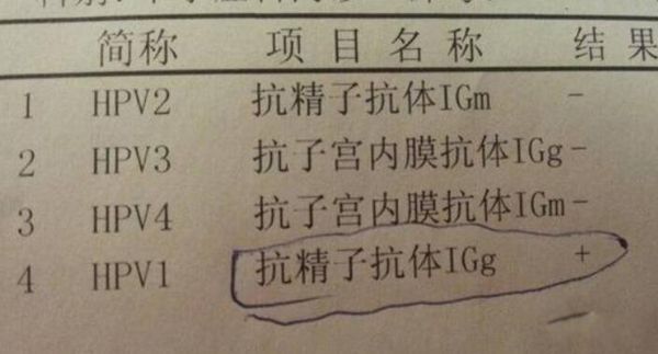 gpal精元抗体是真的吗 gpal化验单是检查什么的