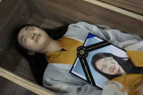 尸绿最先出现的部位是哪里 尸绿长什么样子图片