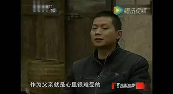僵尸男孩为什么死了 重庆僵尸男孩真实事件得了什么病