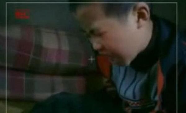 僵尸男孩为什么死了 重庆僵尸男孩真实事件得了什么病