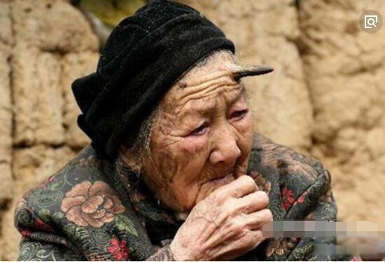 头上有犄角的老人 老人头上长角是怎么回事