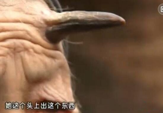 头上有犄角的老人 老人头上长角是怎么回事
