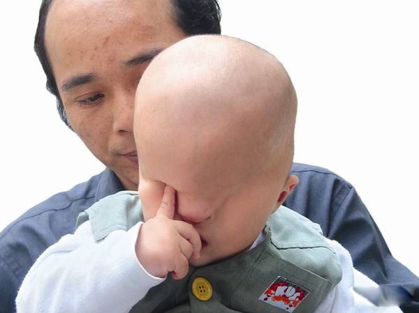 产妇生出无眼娃 生下来没眼睛的小孩怎么回事啊