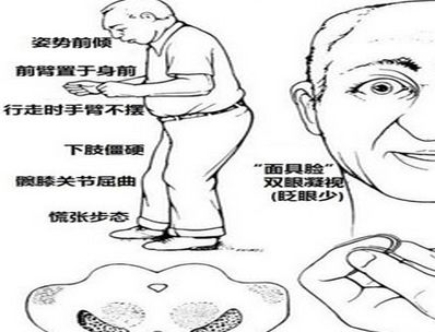 必死病有哪些 十大必死绝症排名榜(绝症排行榜)