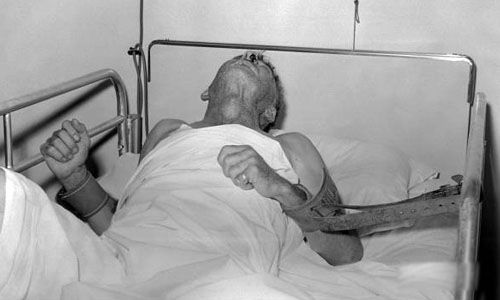 必死病有哪些 十大必死绝症排名榜(绝症排行榜)