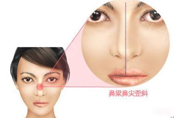 死亡是什么概念 人临死前的15个征兆详解