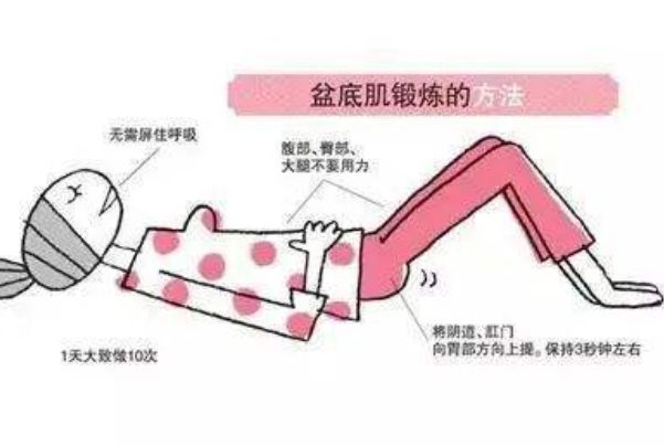凯格尔运动害人吗 凯格尔运动正确做法和对女性的好处