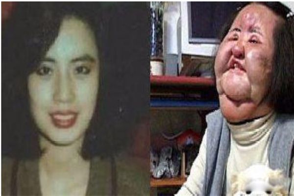 电风扇阿姨去世 韩国整容失败电风扇大妈的故事