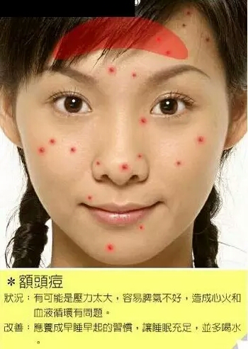 长痘痘的位置图解 长痘痘是因为什么原因引起的