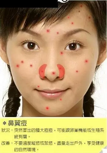 长痘痘的位置图解 长痘痘是因为什么原因引起的