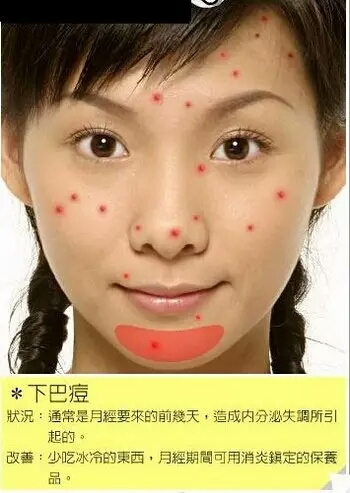 长痘痘的位置图解 长痘痘是因为什么原因引起的