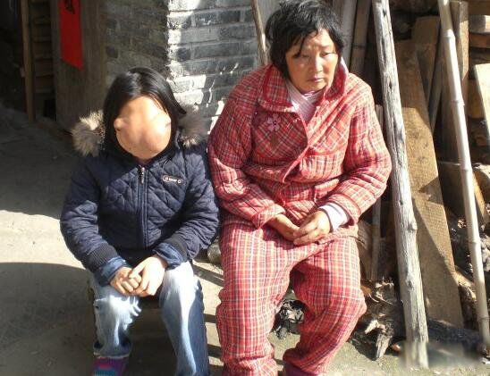 吴晓燕的脸手术后现在的样子 马脸女孩吴小燕怎么样了