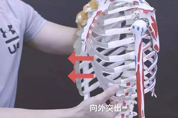 肋骨不外翻和外翻图片 穿紧身上衣远看就能判断出来
