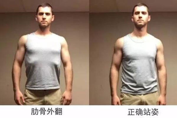 肋骨不外翻和外翻图片 穿紧身上衣远看就能判断出来