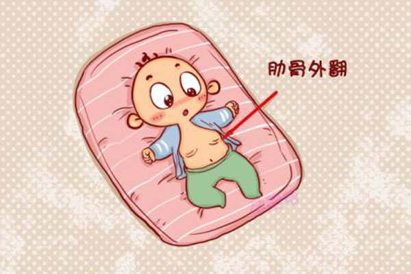 肋骨不外翻和外翻图片 穿紧身上衣远看就能判断出来