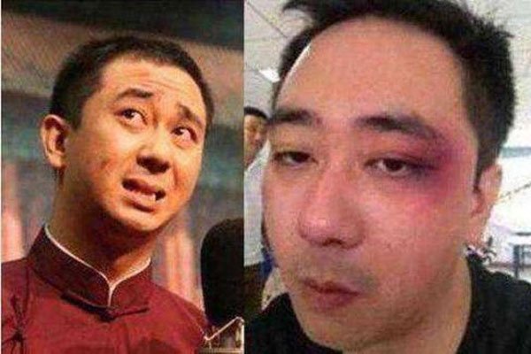 王自健被老婆打是真的吗 大男人被欺负现在离婚没