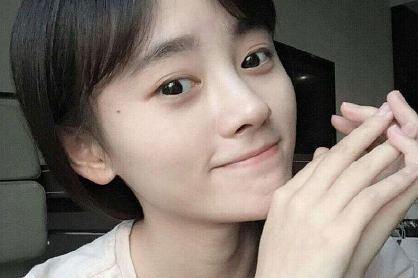 鞠婧祎整容网红前照片 四千年美女素颜丑照对比图片