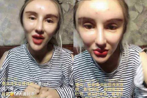 桃花宝宝是男是女 整容整成这样子是男是女也不重要了
