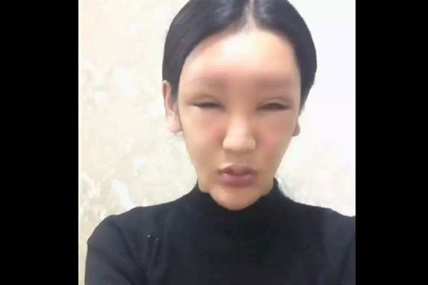 桃花宝宝是男是女 整容整成这样子是男是女也不重要了