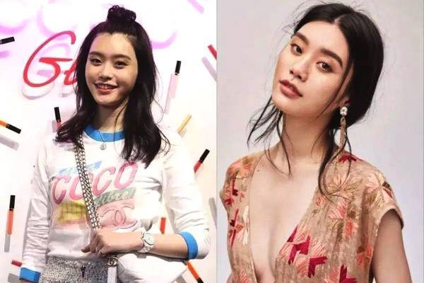 奚梦瑶面部填充整容对比 整容改命一跃嫁入豪门