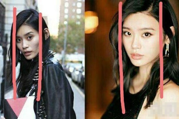 奚梦瑶面部填充整容对比 整容改命一跃嫁入豪门