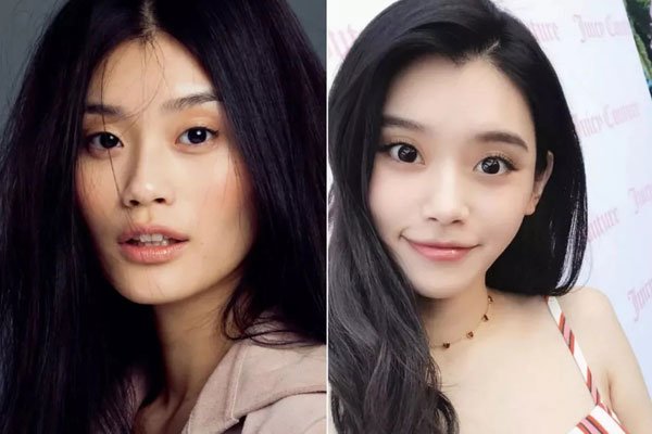 奚梦瑶面部填充整容对比 整容改命一跃嫁入豪门