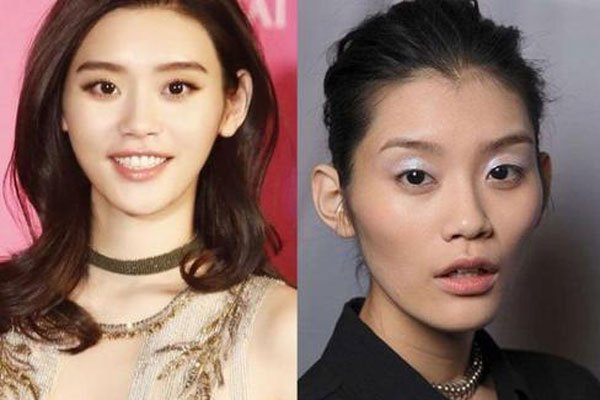 奚梦瑶面部填充整容对比 整容改命一跃嫁入豪门