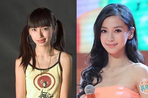 杨颖整容是真是假 整容前后后遗症