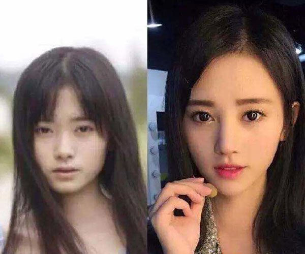 鞠婧祎整容网红前照片 鞠婧祎究竟有没有整容