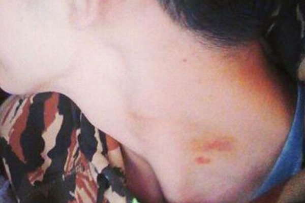 种草莓是什么意思啊 男女种草莓代表睡过了吗