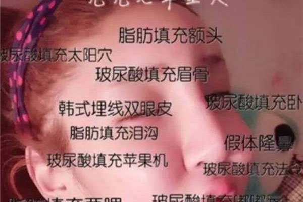 桃花宝宝是男的女的 整容真的好可怕感觉好疼好疼