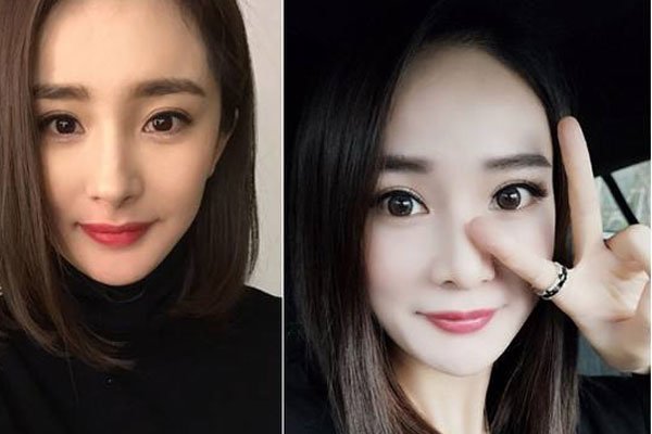 桃花宝宝是男的女的 整容真的好可怕感觉好疼好疼