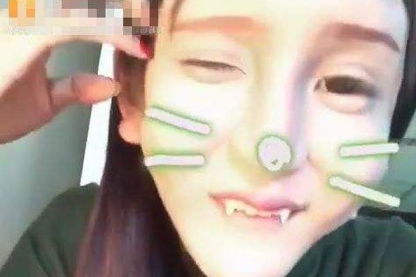 桃花宝宝是男的女的 整容真的好可怕感觉好疼好疼