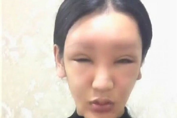 桃花宝宝是男的女的 整容真的好可怕感觉好疼好疼