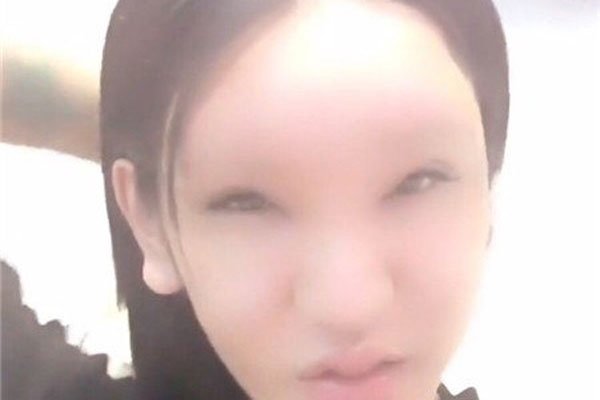 桃花宝宝是男的女的 整容真的好可怕感觉好疼好疼