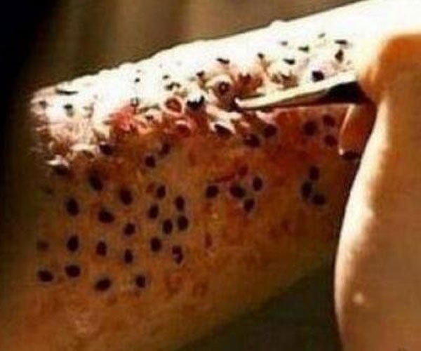 莲蓬乳,空手指,芝麻手是怎么形成的 这么恶心是什么病引起的