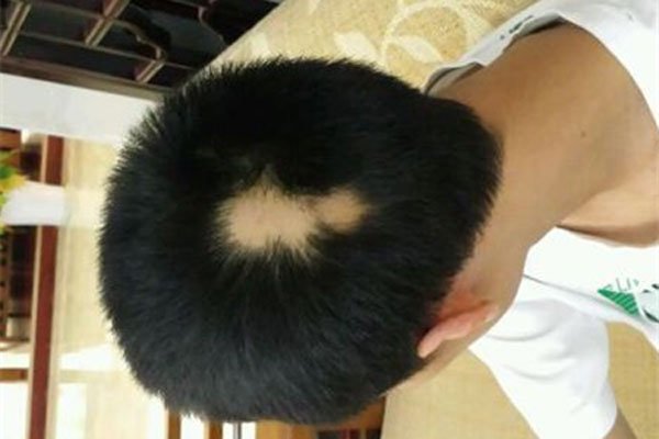 ����ͷ���˶����ɺ��� а�ŵĹ���ͷ����Ϊʲôԭ������Ŀ�ѧ����