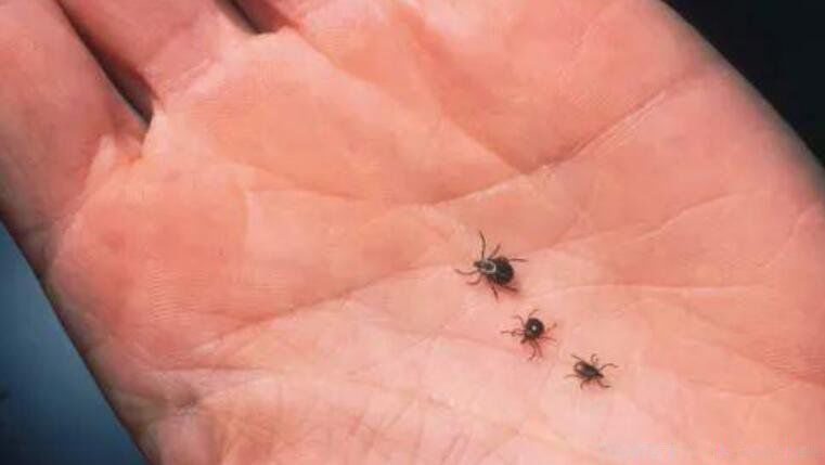 蜱虫咬人伤口辨认图片 死亡率不低:蜱虫咬人后有什么症状,怎么治疗