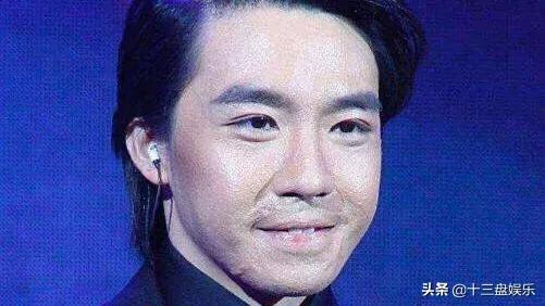 俞灏明火烧事件怎么回事 小鲜肉以前照片:俞灏明火烧前后对比