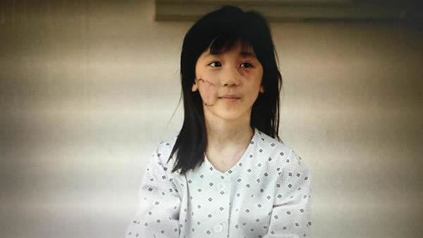 素媛案件真实女孩怎么样了 素媛原型娜英有多惨