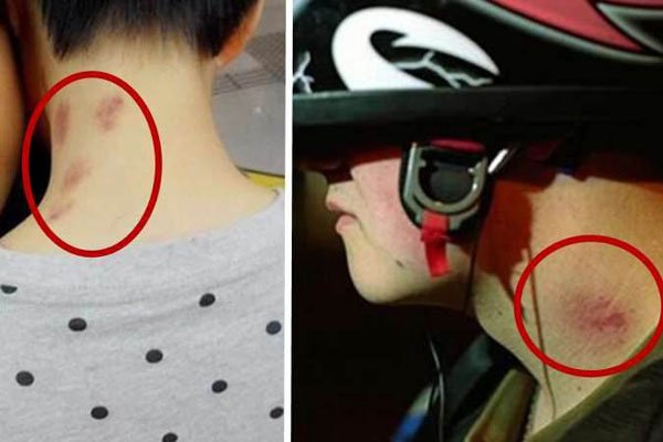 被男生你的草莓感觉 被男生种草莓是什么感觉会疼吗