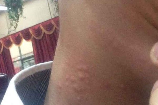 被男生你的草莓感觉 被男生种草莓是什么感觉会疼吗