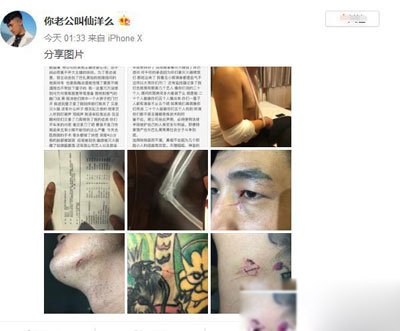 巴扎黑聊城5人对战仙洋30人视频经过 网红巴扎黑一人吓住仙洋十几个人